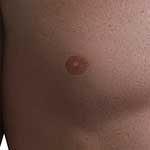 100 Pics Body Parts Answers Level 42