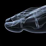 100 Pics Body Parts Answers Level 69