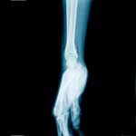 100 Pics Body Parts Answers Level 84