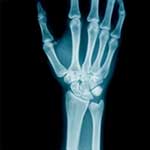100 Pics Body Parts Answers Level 85